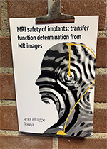 ISBN: 9789039372418 - Title: MRI safety of implants: transfer function determination from MR images